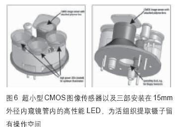 低成本CMOS图像传感器推动医学技术向前发展(图6)