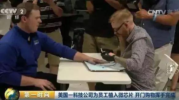 全球最狠女车主！把车钥匙装进自己手臂看着太吓人了(图7)
